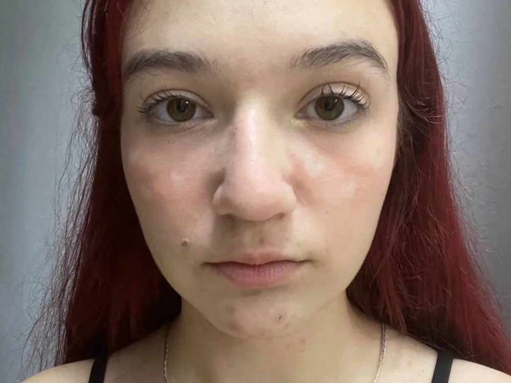 ArielDarter
