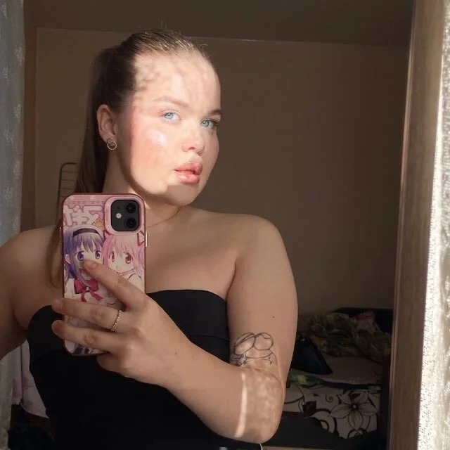 ChloeWinks