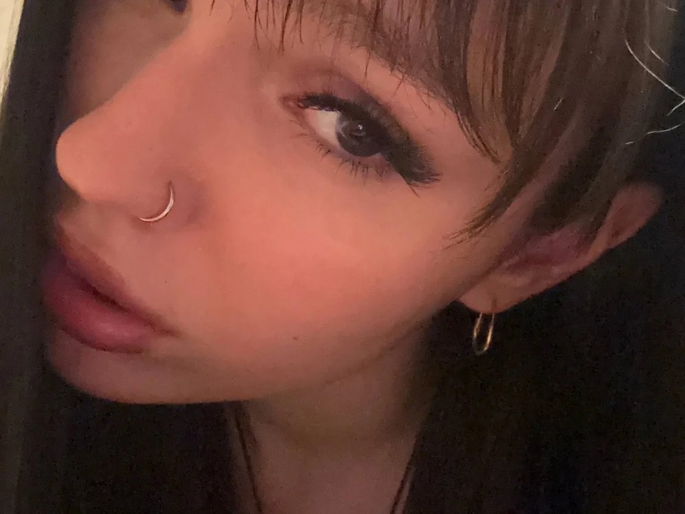 Kissalexia