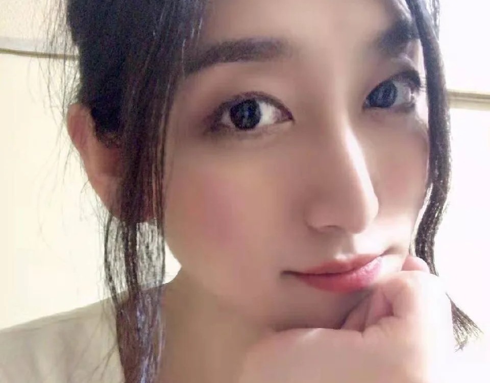 cholesister