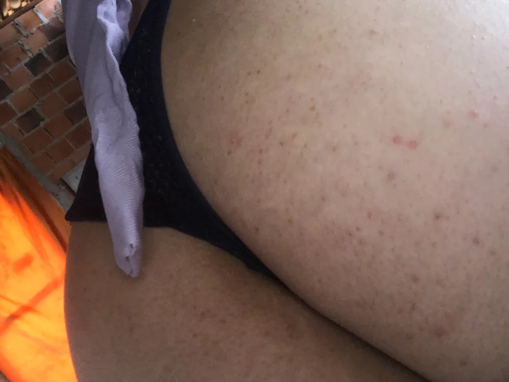 novinha__anal